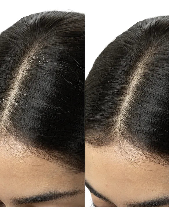 Brillare dandruff control shampoo 300ml